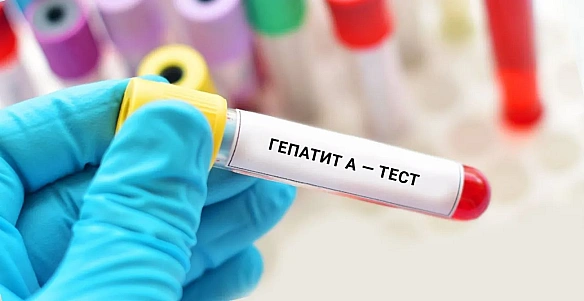we.ua - Спалах гепатиту А у Києві: спеціалісти не виключають розгортання додаткових мобільних пунктів обстеження