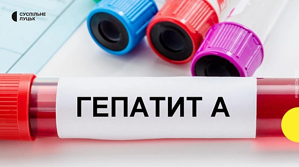 we.ua - У громаді на Волині виявили вірусний гепатит А: як вберегтися