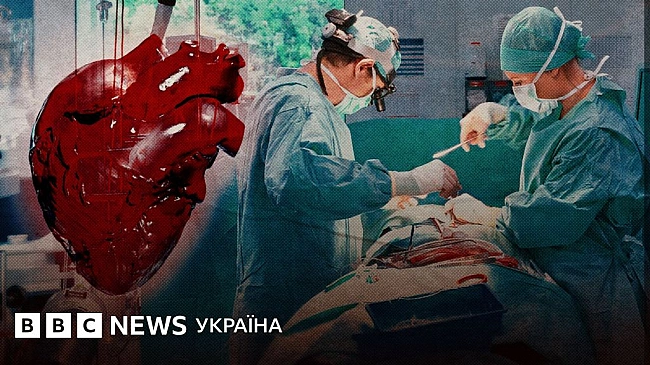 we.ua - Ніби дивом із серця діставали осколок. Як унікальний винахід українців для фронту здивував західних лікарів