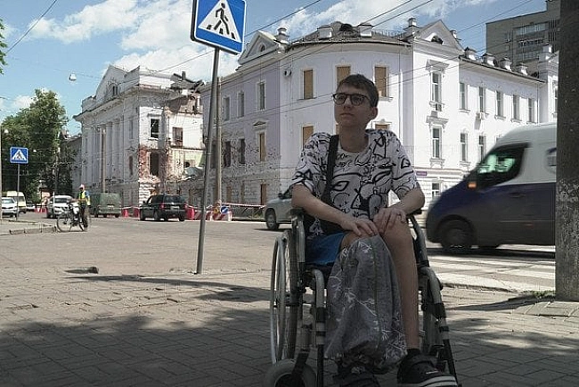 we.ua - Секунда і я вже лежу: 13-річний Іван пережив 8 операцій після удару РФ по Сумах
