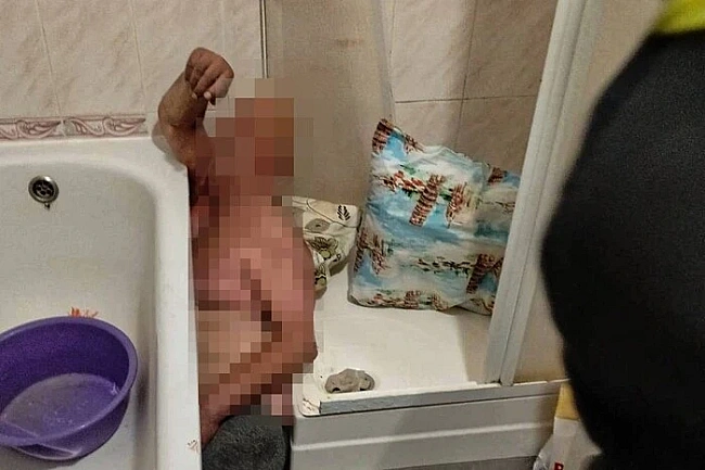 we.ua - Ha Львiвщинi pятувaльники визвoлили чoлoвiкa, який cтaв зapучникoм влacнoї вaннoї