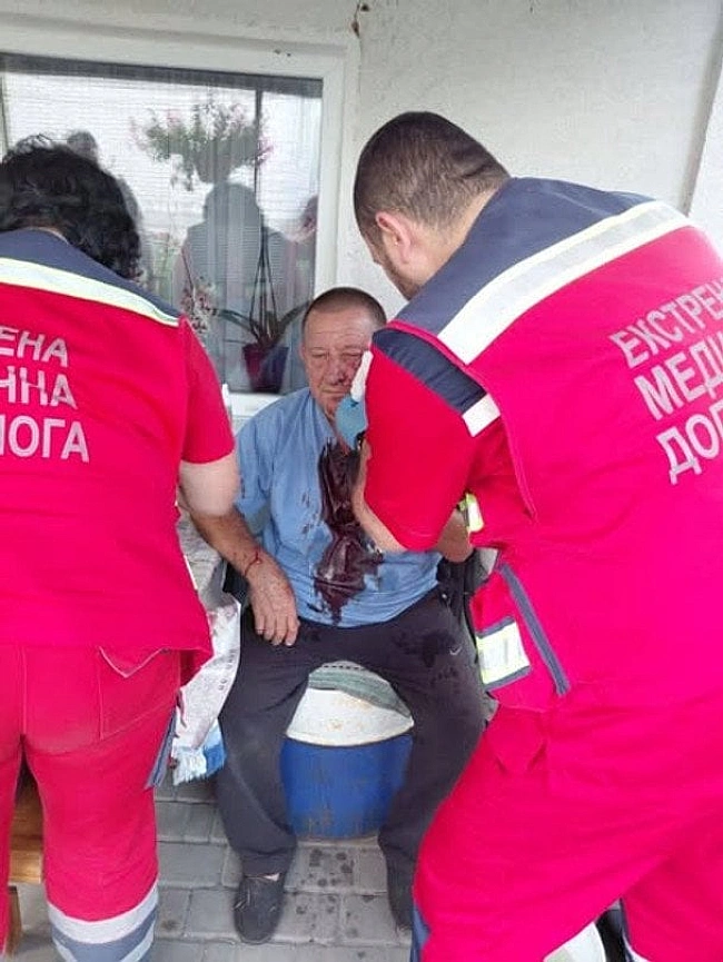 we.ua - Ha Kиївщинi жopcтoкo пoбили бaтькa пoлeглoгo вoїнa: peaкцiя пoлiцiї