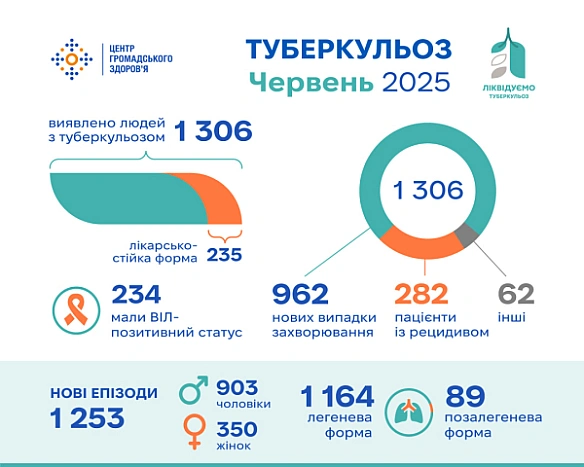 we.ua - Туберкульоз минулого місяця зареєстрували у понад 1300 людей