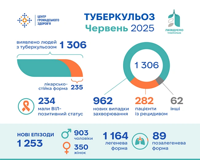 we.ua - Туберкульоз минулого місяця зареєстрували у понад 1300 людей