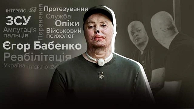 we.ua - Розумів, що живий – це вже добре, – інтерв'ю з Єгором Бабенком про важкі поранення і нове життя