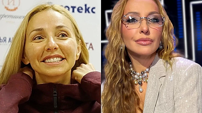 we.ua - Перекроїла обличчя, але стверджує, що за натуральність: які пластичні операції робила дружина Пєскова Навка