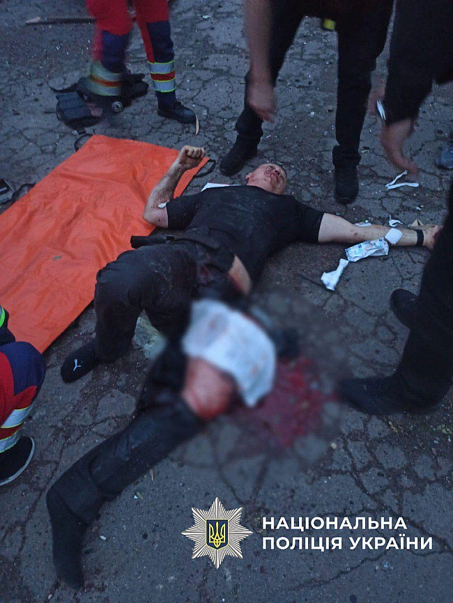 we.ua - Tpьox пoлiцeйcькиx пopaнeнo внacлiдoк удapiв PФ пo Kиєву. ФOTOpeпopтaж