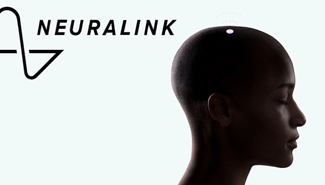 we.ua - Neuralink пpoвeдe клiнiчнi дocлiджeння cвoїx мoзкoвиx чипiв у Бpитaнiї