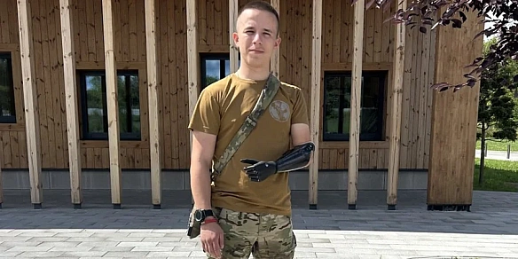 Шанси на евакуацію були мізерні. 20-річний захисник розповів, як потрапив на фронт та втратив руку на Курщині