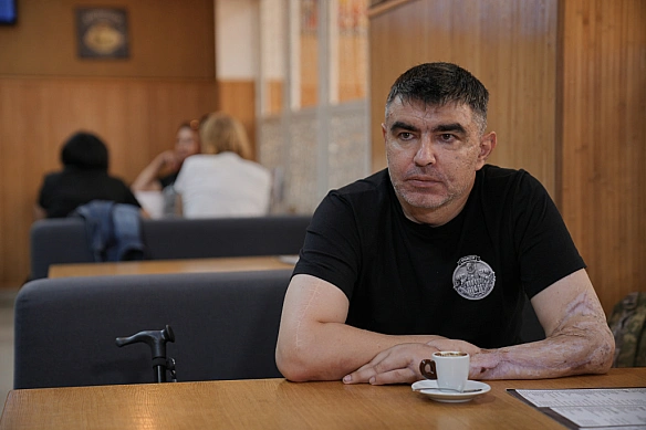 Критика невідомої на відкритий протез ветерана із Полтавщини: що сталося