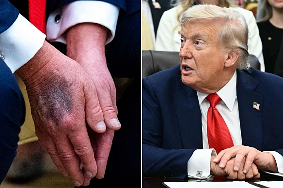 Зникнення Трампа: як тиша породила хвилю чуток про смерть і хвороби. Пояснюємо