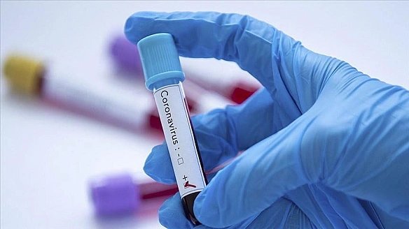 В Україні поширюється COVID-19: лікарі попереджають про ризики та закликають до вакцинації