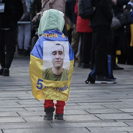 Київ об’єднався в болючій єдності.Акція \