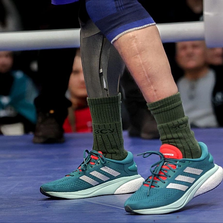 Сталь у погляді, титан у кроці.​Це Сергій. Боєць 112 окрема бригада Сил територіальної оборони ЗСУ. Своє поранення він отримав... - Репортер інформує on we.ua