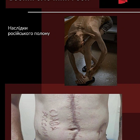 ПРАВО НА ПРАВДУ ТА ВШАНУВАННЯ ПАМ'ЯТІ ЖЕРТВ

24 березня світ відзначає Міжнародний день права на встановлення істини щодо грубих... - Український інститут національної пам'яті on weua.dev