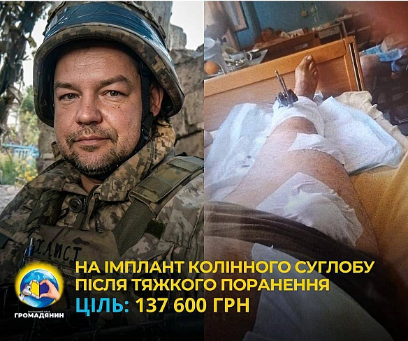 Збір БФ «Громадянин»:‼️Два важкі поранення. Зруйноване коліно. Постійний біль. Потрібне ендопротезування.🫡🇺🇦 Руслан Хлистун,... - on we.ua