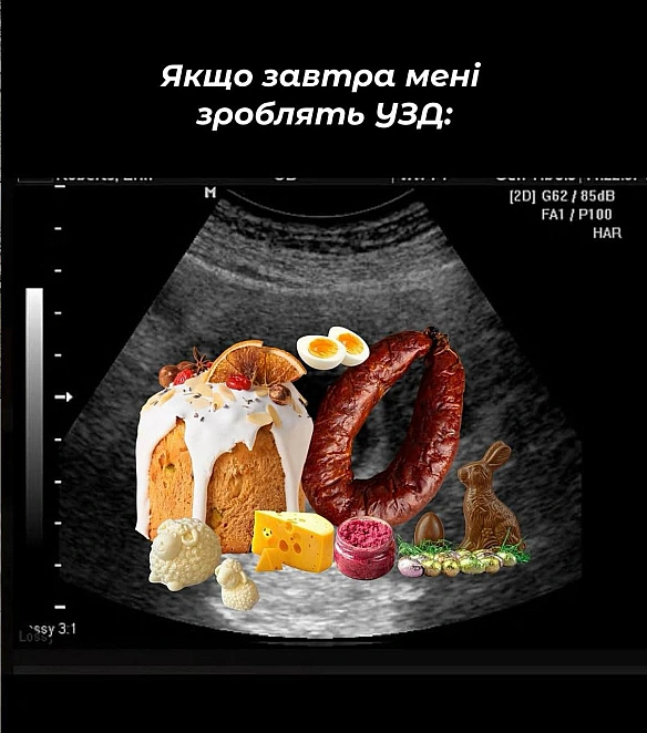 Хто з вас?#хзчиймем@memargam - МЕМАГРАМ на we.ua