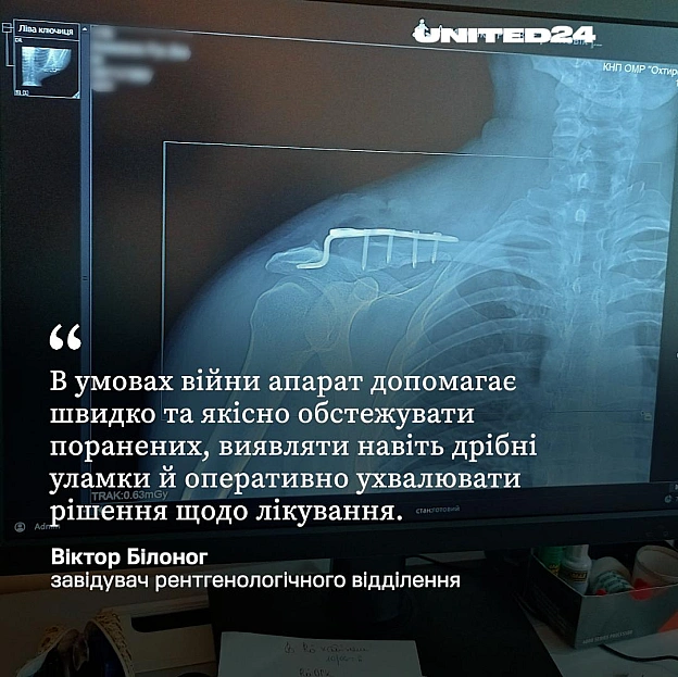 11 сучасних рентгенологічних установок, придбаних завдяки внескам партнерів та донорів UNITED24, уже доставлені та працюють у лі... - на we.ua