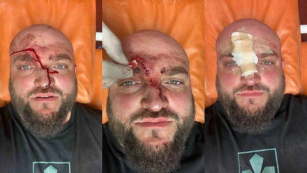 На Одещині напали на діючого військового за прохання вимкнути російську музикуЗа даними дружини ветерана, інцидент стався у го... - на we.ua