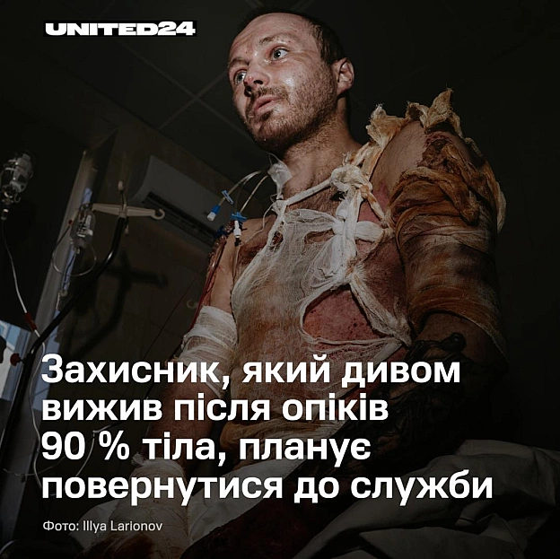 Я заживо горів. Родом із Житомирщини, Андрій вступив до лав Збройних Сил України у 2018 році. Починав стрільцем, але невдовзі ... - на we.ua