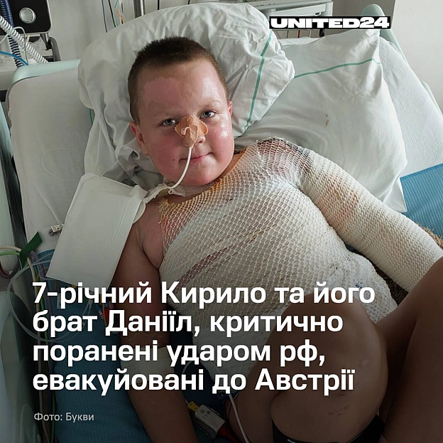 Увечері 17 липня російський «шахед» влучив у житловий будинок родини у Новгороді-Сіверському на Чернігівщині. Всередині перебува... - на we.ua
